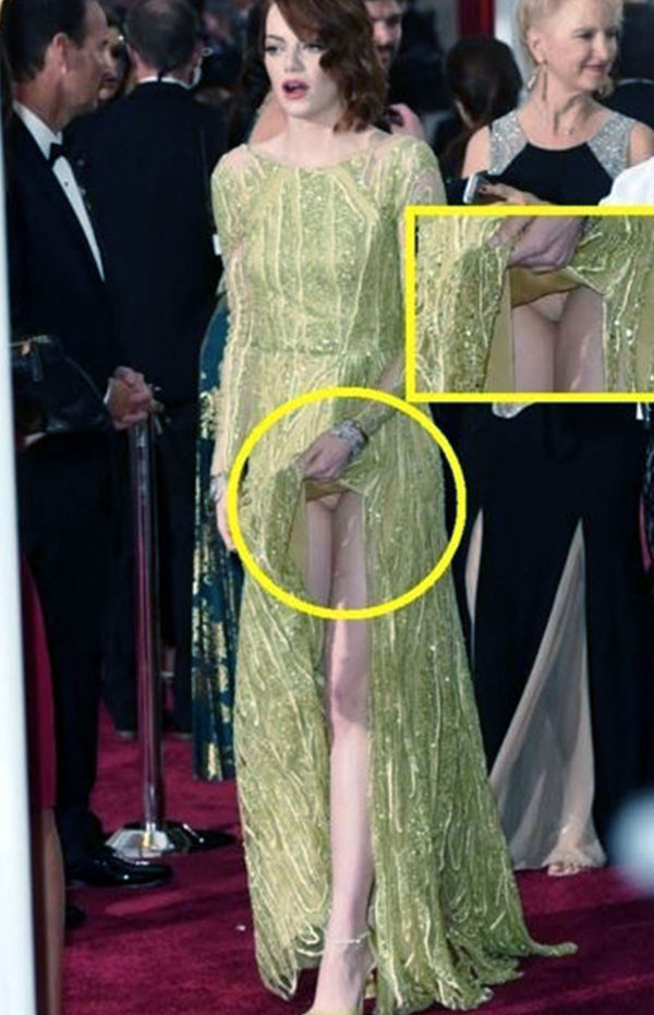 Emma stone nude, sexy, leaked, hacked, fappening photos 553 hot pics, emma stone nude, sexy, leaked, hacked, fappening photos 553 bio, emma stone nude, sexy, leaked, hacked, fappening photos 553 twitter instagram Emma stone nude, sexy, leaked, hacked, fappening photos 552 hottest pics, emma stone nude, sexy, leaked, hacked, fappening photos 552 instagram