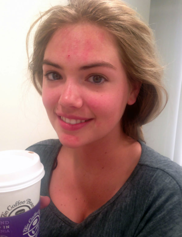 Kate upton naked lekad pics & sex tape & hot movie scenes 161 hot pics, kate upton naked lekad pics & sex tape & hot movie scenes 161 bio, kate upton naked lekad pics & sex tape & hot movie scenes 161 twitter instagram Kate upton naked lekad pics & sex tape & hot movie scenes 160 hottest pics, kate upton naked lekad pics & sex tape & hot movie scenes 160 instagram